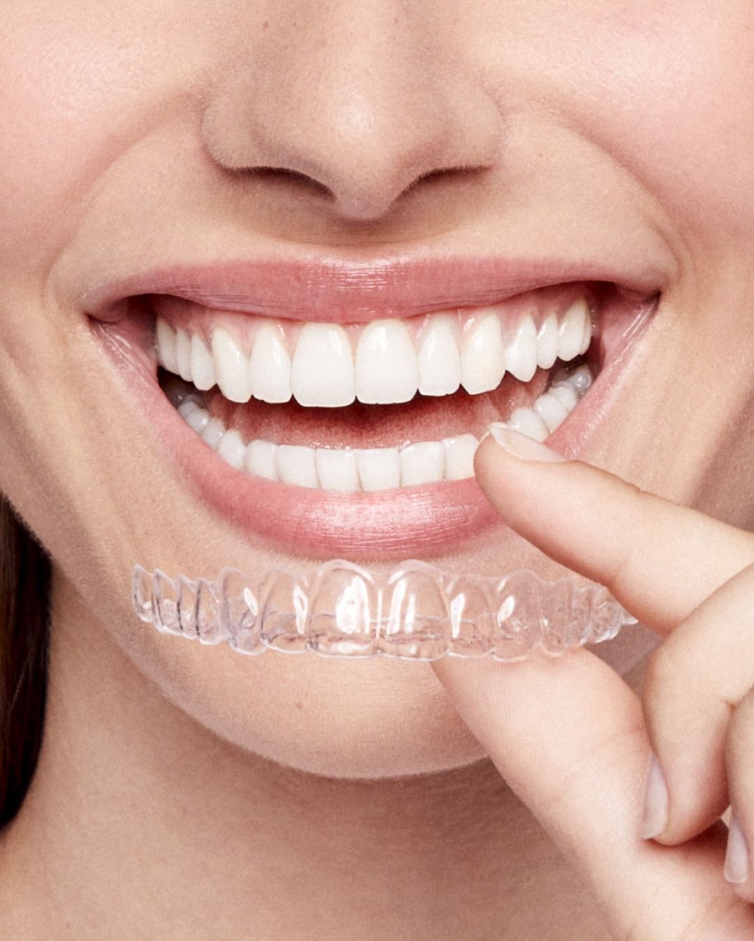 Clear Smile Aligner
